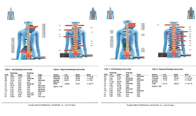 MyoVision Thermal scanning